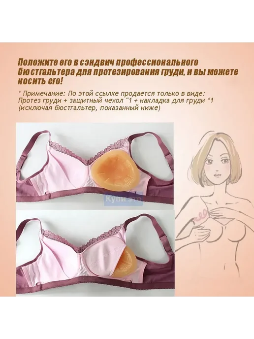 Силиконовый протез молочной железы после мастэктомии, вариант, фото 5