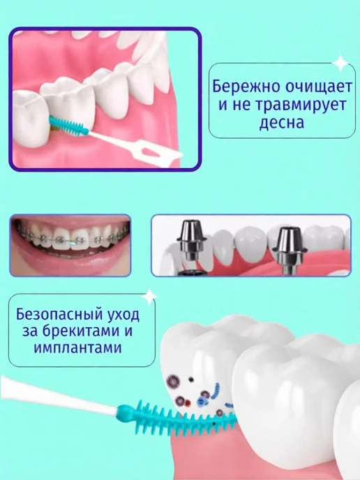 Межзубные ершики 20 шт, диаметр 1 мм, мягкие, зелёные, 20 шт, фото 2