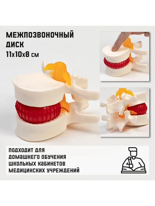 Нет бренда Анатомическая модель межпозвонкового диска 11х10х8 см, 10x8 см