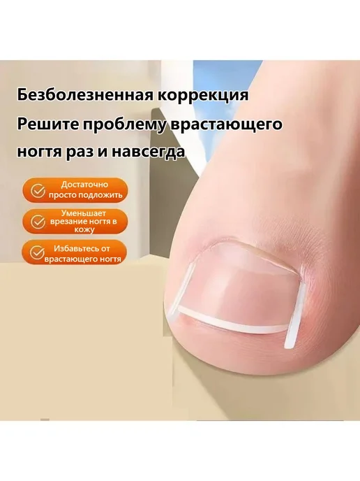 Корректоры для вросших ногтей на ногах, 30 шт. + подъёмник, 30 шт, фото 2